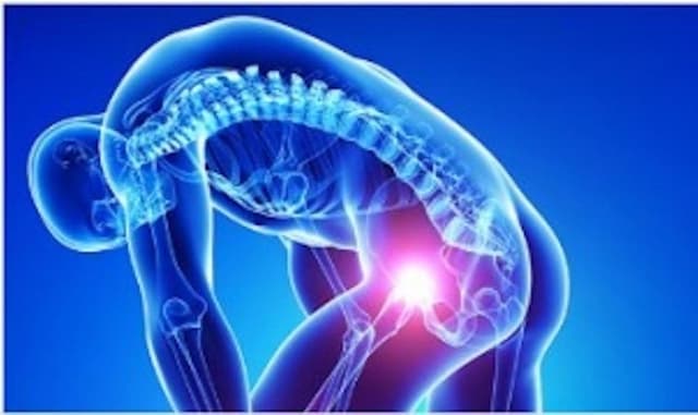 Musculoskeletal Primer for the Non-Orthopedist